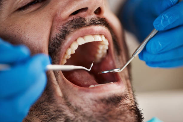 Best Tooth Infection Emergency Dentist  in Winchester, MO